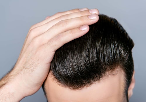 Does a Hair Transplant Clinic Offer Free Consultations or Evaluations Before Scheduling an Appointment?