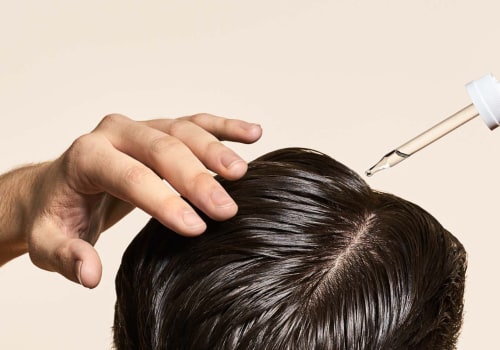 Non-Surgical Alternatives to Hair Transplant Surgery: A Comprehensive Guide